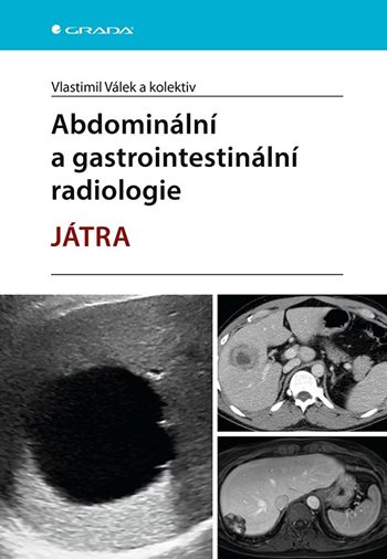 Abdominální a gastrointestinální radiologie - Játra