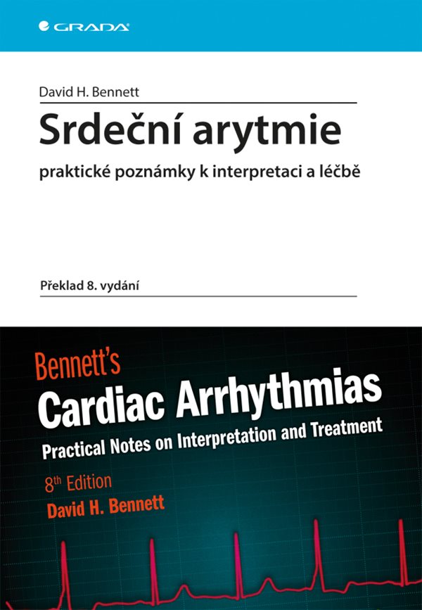Srdeční arytmie praktické poznámky k interpretaci a léčbě torent