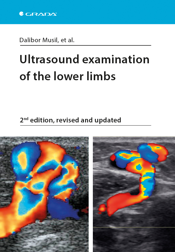 Levně Ultrasound examination of the lower limbs, Musil Dalibor