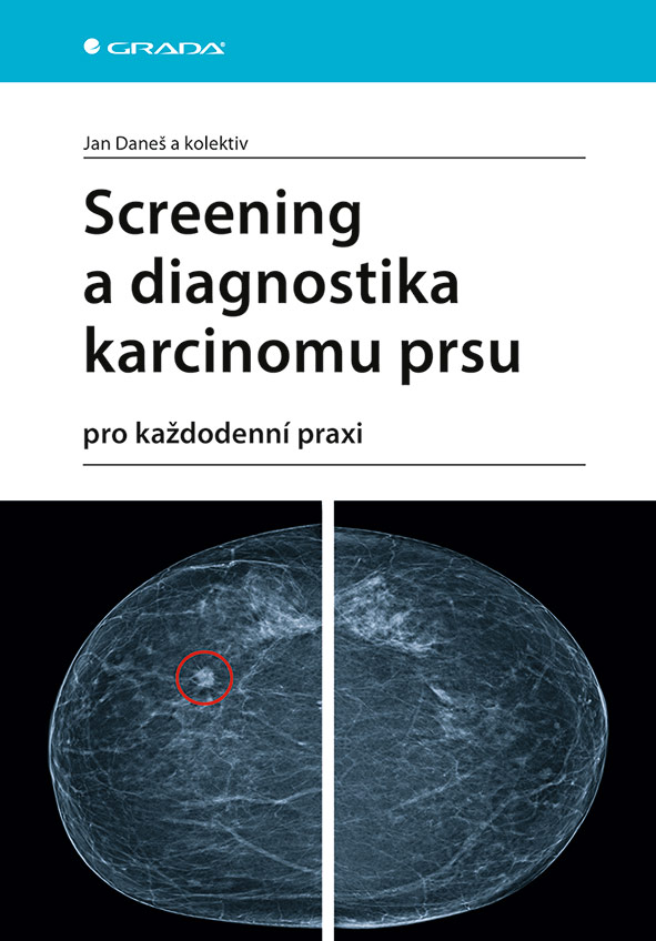 Levně Screening a diagnostika karcinomu prsu, Daneš Jan