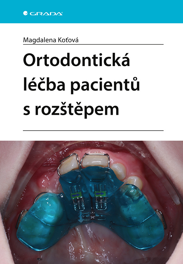 Levně Ortodontická léčba pacientů s rozštěpem, Koťová Magdalena