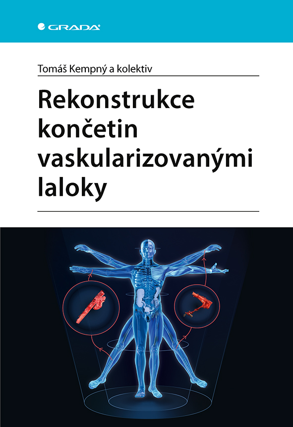 Kniha: Rekonstrukce končetin vaskularizovanými laloky od Kempný Tomáš