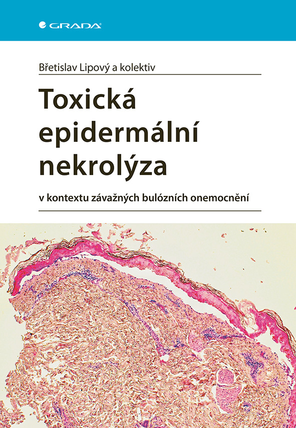 Kniha: Toxická epidermální nekrolýza od Lipový Břetislav