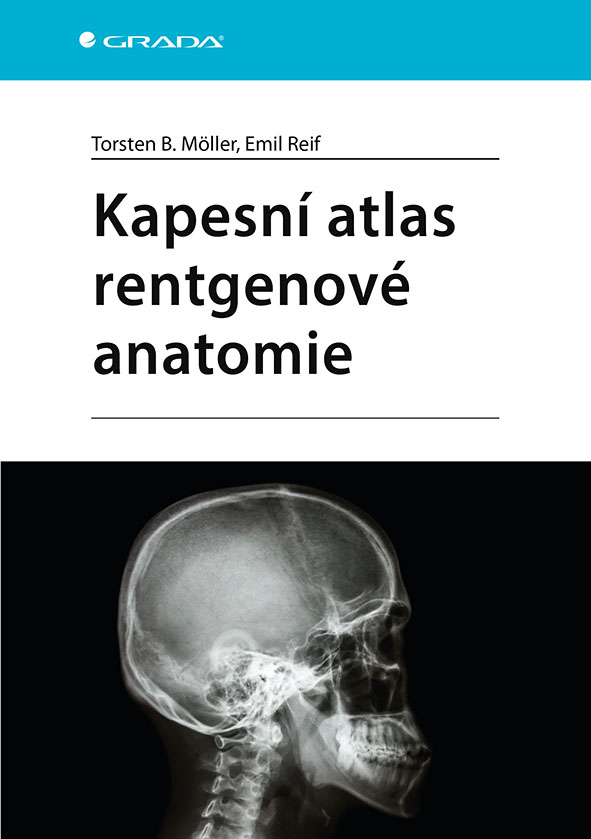 Kniha: Kapesní atlas rentgenové anatomie od Möller Torsten B.