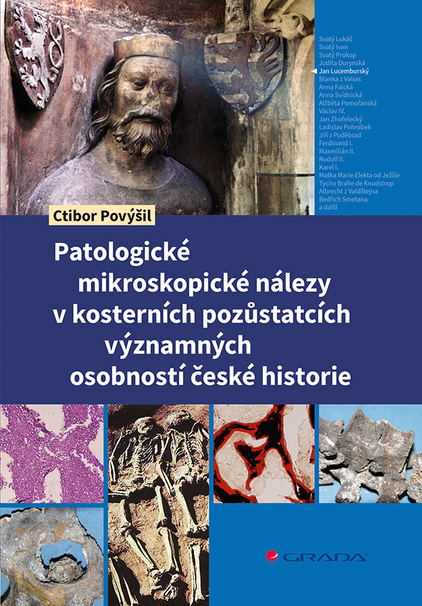 Kniha Patologické mikroskopické nálezy v kosterních pozůstatcích významných osobností české historie