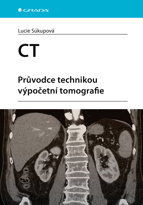 E-kniha: CT - Průvodce technikou výpočetní tomografie od Súkupová Lucie