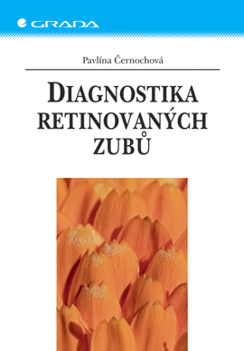 Levně Diagnostika retinovaných zubů, Černochová Pavlína
