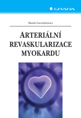 Levně Arteriální revaskularizace myokardu, Gwozdziewicz Marek