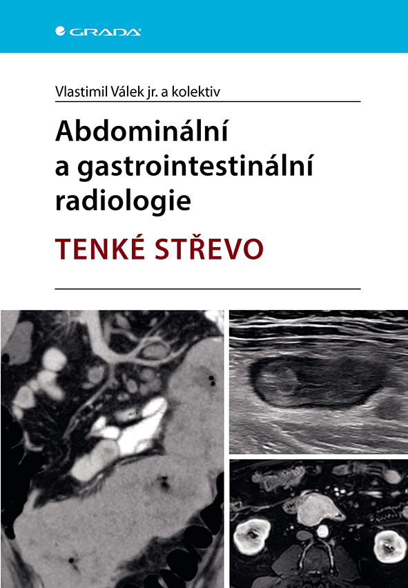 Kniha: Abdominální a gastrointestinální radiologie od Válek jr. Vlastimil